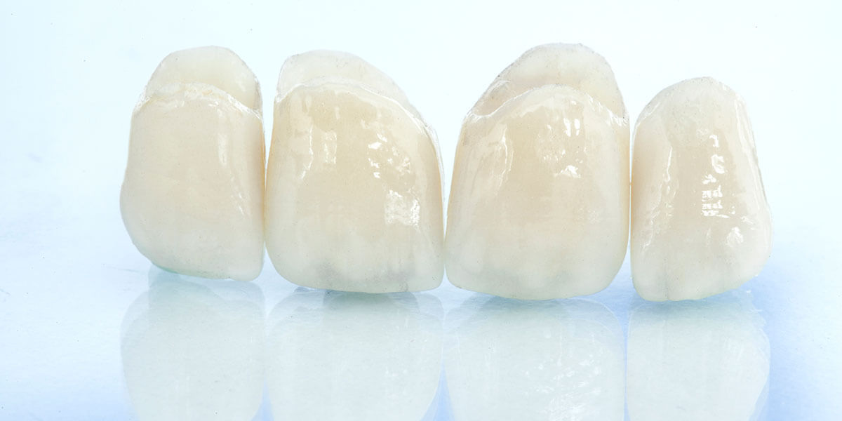 Ceramic Implants